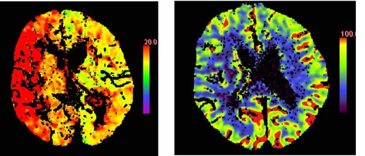 Neuroradiologie - CT Aufnahmen (medbo | Isabel Wiesinger)