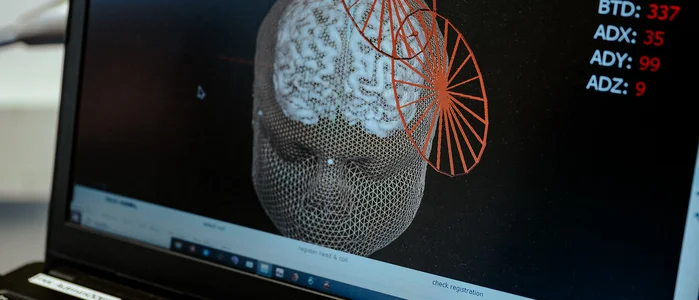 Zentrum für Neuromodulation BKR Monitor Neuronavi (Frank Hübler | medbo)