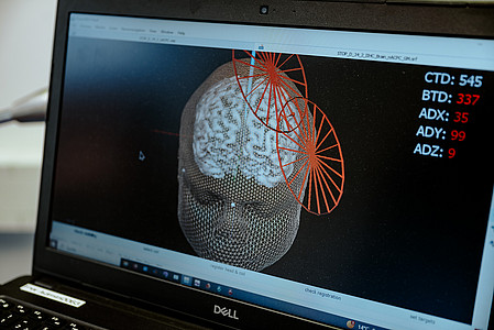 Zentrum für Neuromodulation BKR Monitor Neuronavi (Frank Hübler | medbo)
