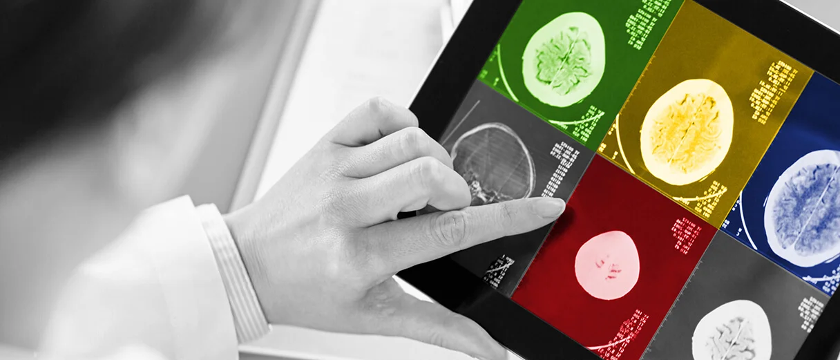 Hirnscans (Neustockimages/iStock)