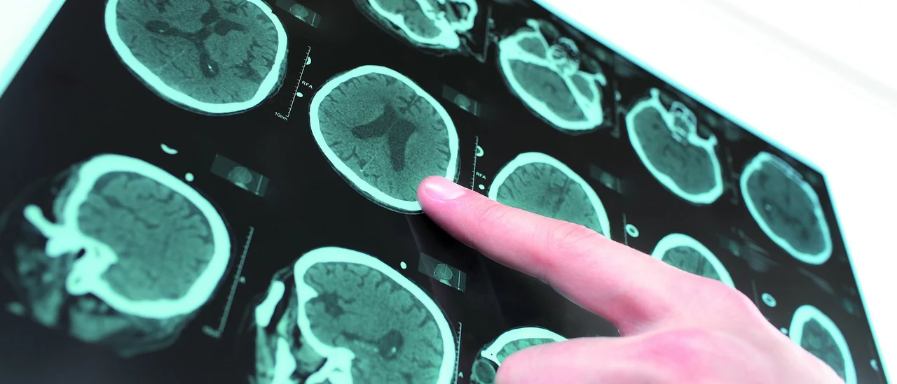 Gehirnscans_Hand_c_Yuriy-Klochan_istock