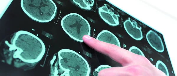 Gehirnscans_Hand_c_Yuriy-Klochan_istock